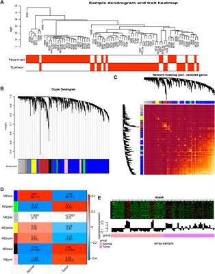 Integrated Analysis of Glutathione Metabolic Pathway in Pancreatic Cancer